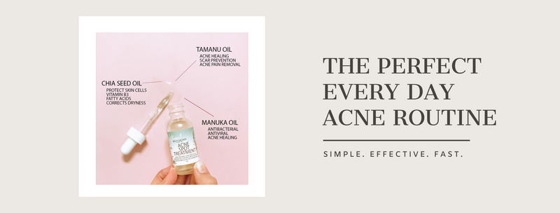 The Perfect Everyday Acne Routine!