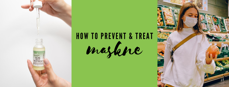 How to Prevent & Treat Maskne